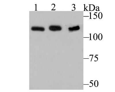 Western Blot: hnRNP U Antibody (JB23-43) [NBP2-75526] - Analysis of HnRNP U on different cell lysates using anti-HnRNP U at 1/500 dilution.Positive control:Lane 1: NIH-3T3         Lane 2: SH-SY-5YLane 3: K562