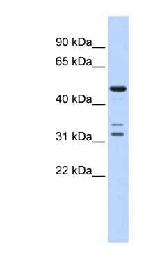 Western Blot: htrA4 Antibody [NBP1-62690] - Human Brain lysate, concentration 0.2-1 ug/ml.