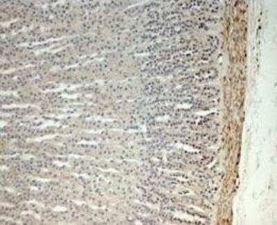 Immunohistochemistry-Paraffin: hydroxysteroid (17-beta) dehydrogenase 11 Antibody [NBP1-57081] - Monkey adrenal gland.