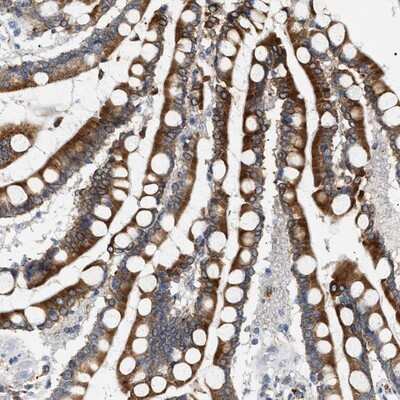 Immunohistochemistry-Paraffin: hydroxysteroid (17-beta) dehydrogenase 11 Antibody [NBP1-90334] - Staining of human colon shows strong cytoplasmic positivity in glandular cells.