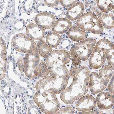 Immunohistochemistry-Paraffin: hydroxysteroid (17-beta) dehydrogenase 11 Antibody [NBP1-90334] - Staining of human kidney shows weak to moderate cytoplasmic positivity in cells in tubules.
