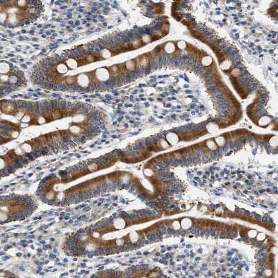 Immunohistochemistry-Paraffin: hydroxysteroid (17-beta) dehydrogenase 11 Antibody [NBP1-90334] - Staining of human duodenum shows moderate to strong cytoplasmic positivity in glandular cells.