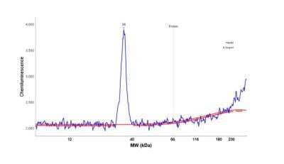 Simple Western: hydroxysteroid (17-beta) dehydrogenase 11 Antibody [NBP1-90334] - Simple Western: hydroxysteroid (17-beta) dehydrogenase 11 Antibody [NBP1-90334] - Electropherogram image of the corresponding Simple Western lane view. hydroxysteroid (17-beta) dehydrogenase 11 antibody was used at 1:25 dilution on HepG2 lysate(s) respectively.