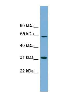 Western Blot hydroxysteroid (17-beta) dehydrogenase 11 Antibody - BSA Free