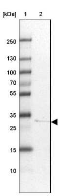 Western Blot: hydroxysteroid (17-beta) dehydrogenase 11 Antibody [NBP1-90334] - Lane 1: Marker  [kDa] 250, 130, 100, 70, 55, 35, 25, 15, 10.  Lane 2: Hep-G2