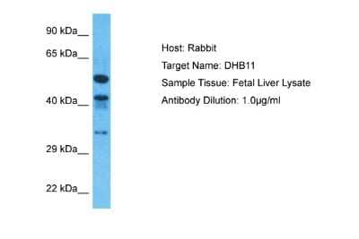 Western Blot: hydroxysteroid (17-beta) dehydrogenase 11 Antibody [NBP2-85087] - Host: Rabbit. Target Name: DHB11. Sample Type: Fetal Liver lysates. Antibody Dilution: 1.0ug/ml