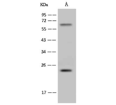 Western Blot: hydroxysteroid (17-beta) dehydrogenase 11 Antibody [NBP2-99361] - Anti-hydroxysteroid (17-beta) dehydrogenase 11 rabbit polyclonal antibody at 1:500 dilution. Lane A: RAW264.7 Whole Cell Lysate Lysates/proteins at 30 ug per lane. Secondary Goat Anti-Rabbit IgG (H+L)/HRP at 1/10000 dilution. Developed using the ECL technique. Performed under reducing conditions. Predicted band size: 23 kDa. Observed band size: 23 kDa