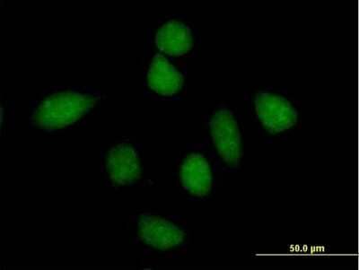 Immunocytochemistry/Immunofluorescence: iASPP Antibody [H00010848-B01P] - Analysis of purified antibody to PPP1R13L on HeLa cell. (antibody concentration 10 ug/ml)