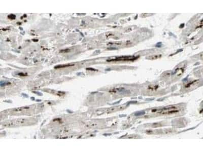 Immunohistochemistry: iASPP Antibody [NBP1-77912] - Staining of myocytes in human heart tissue. Tissue was formalin-fixed and paraffin embedded. Brown color indicates presence of protein, blue color shows cell nuclei.