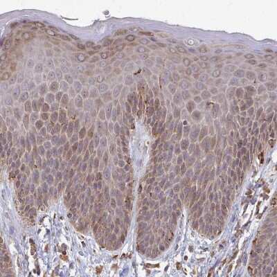 Immunohistochemistry-Paraffin: iASPP Antibody [NBP2-38879] - Staining of human skin shows moderate cytoplasmic positivity in epidermal cells.