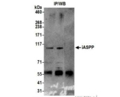 <b>Independent Antibodies Validation and Biological Strategies Validation.</b>Immunoprecipitation: iASPP Antibody [NB100-88155] - Whole cell lysate (0.5 or 1.0 mg per IP reaction; 20% of IP loaded) from 293T cells prepared using NETN lysis buffer. Antibodies: Affinity purified rabbit antiiASPP antibody used for IP at 6 ug per reaction. iASPP was also immunoprecipitated by a previous lot of this antibody. For blotting immunoprecipitated iASPP,  was used at 0.4 ug/ml. Detection: Chemiluminescence with an exposure time of 3 minutes