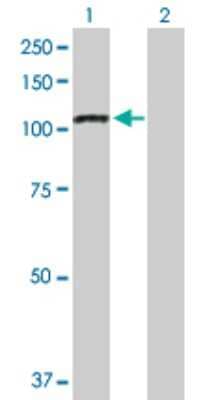 Western Blot: iASPP Antibody [H00010848-D01P] - Analysis of PPP1R13L expression in transfected 293T cell line by PPP1R13L polyclonal antibody.Lane 1: PPP1R13L transfected lysate(89.10 KDa).Lane 2: Non-transfected lysate.