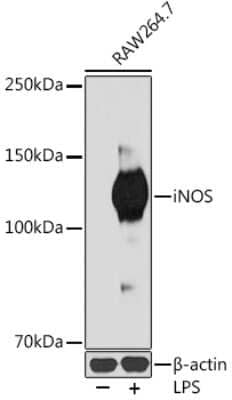 Western Blot: iNOS Antibody (3L0U6) [NBP3-16273] - Western blot analysis of extracts of RAW264.7 cells, using iNOS antibody (NBP3-16273) at 1:1000 dilution.RAW264.7 cells were treated by LPS (1 ug/ml) at 37C for 8 hours. Secondary antibody: HRP Goat Anti-Rabbit IgG (H+L) at 1:10000 dilution. Lysates/proteins: 25ug per lane. Blocking buffer: 3% nonfat dry milk in TBST. Detection: ECL Basic Kit. Exposure time: 180s.