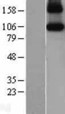 Western Blot: iNOS Overexpression Lysate (Adult Normal) [NBL1-13721] Left-Empty vector transfected control cell lysate (HEK293 cell lysate); Right -Over-expression Lysate for iNOS.