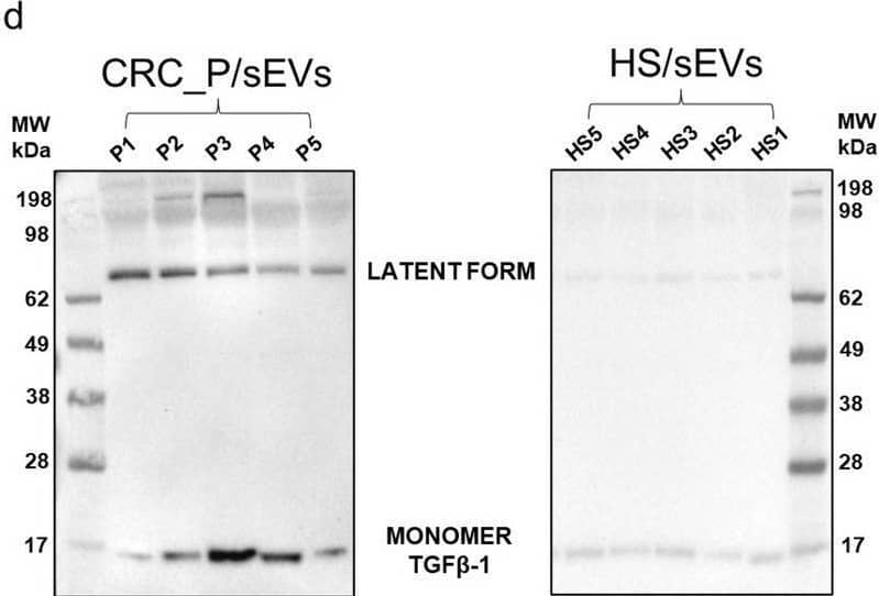 Characterization of sEVs isolated from the plasma of CRC patients (CRC_P/sEVs) and healthy subjects (HS/sEVs). Representative TEM micrograph (a) and NTA (b) of sEVs isolated from a CRC patient plasma. c Western blot analysis of EV markers (CD81 and Alix) and of proteins expected to be underrepresented in EVs (Calnexin and Cytochrome C). d Western blot analysis of TGF beta 1 in CRC_P/sEVs and HS/sEVs Image collected and cropped by CiteAb from the following open publication (//pubmed.ncbi.nlm.nih.gov/37072829), licensed under a CC-BY license. Not internally tested by R&D Systems.