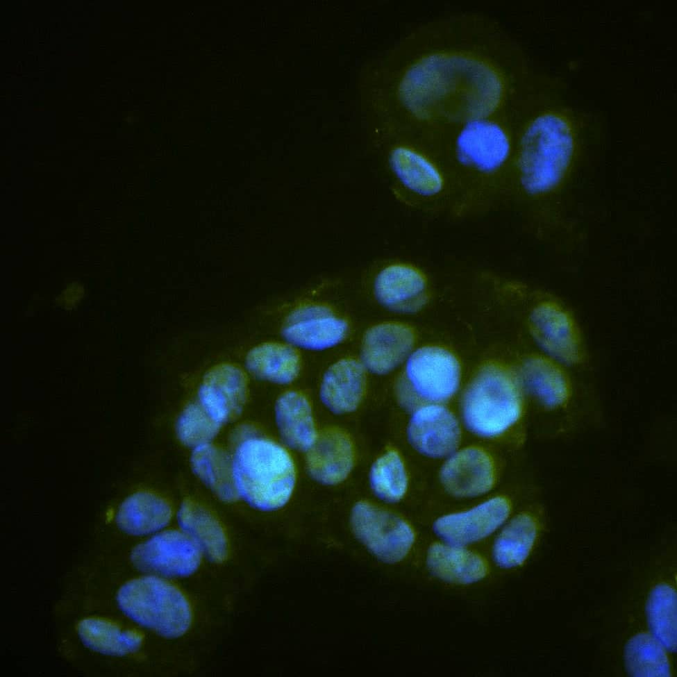 HNF‑3 beta /FoxA2 was detected in immersion fixed HepG2 human hepatocellular carcinoma cell line using Goat Anti-Human HNF‑3 beta /FoxA2 Alexa Fluor® 488‑conjugated Antigen Affinity-purified Polyclonal Antibody (Catalog # IC2400G) at 10 µg/ml for 3 hours at room temperature. Cells were counterstained with DAPI (blue). Specific staining was localized to the nucleus. View our protocol for Fluorescent ICC Staining of Cells on Coverslips.