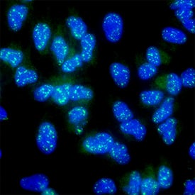 ATF6 was detected in immersion fixed A549 human lung carcinoma cell line using digoxigenin-labeled Rabbit Anti-Human/Mouse/Rat ATF6 Monoclonal Antibody (MAB71527)  at 8 &micro;g/mL for 3 hours at room temperature. Cells were stained using Anti-Mouse Anti-Digoxigenin Alexa Fluor® 488‑conjugated Monoclonal Antibody (Catalog # IC7520G) at 1:10 dilution and counterstained with DAPI (blue). Specific staining was localized to nuclei. Staining was performed using our protocol for Fluorescent ICC Staining of Non-adherent Cells.