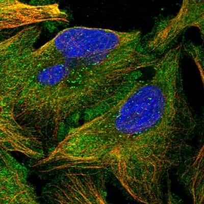 Immunocytochemistry/Immunofluorescence: katanin-p80 Antibody [NBP1-87413] - Staining of human cell line U-2 OS shows localization to plasma membrane, cytosol and microtubules.