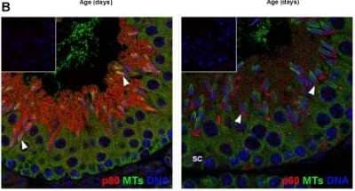 Immunocytochemistry/ Immunofluorescence katanin-p80 Antibody - BSA Free