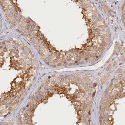 Immunohistochemistry-Paraffin: katanin-p80 Antibody [NBP1-87413] - Staining of human testis shows high expression.