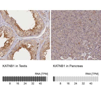<b>Orthogonal Strategies Validation. </b>Immunohistochemistry-Paraffin: katanin-p80 Antibody [NBP1-87413] - Staining in human testis and pancreas tissues using anti-KATNB1 antibody. Corresponding KATNB1 RNA-seq data are presented for the same tissues.