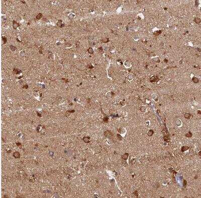 Immunohistochemistry-Paraffin: katanin-p80 Antibody [NBP1-87503] - Staining of human caudate shows strong cytoplasmic positivity in neuronal cells.