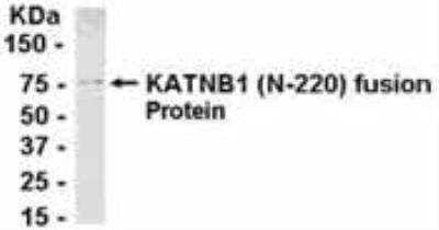 Western Blot: katanin-p80 Antibody [NB100-75489] - E coli-derived fusion protein as test antigen. Affinity-purified IgY dilution: 1:2000, Goat anti-IgY-HRP dilution: 1:1000. Colorimetric method for signal development. ( anti-KAT )
