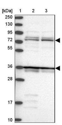Western Blot: katanin-p80 Antibody [NBP1-87413] - Lane 1: Marker  [kDa] 250, 130, 95, 72, 55, 36, 28, 17, 10.  Lane 2: Human cell line RT-4.  Lane 3: Human cell line U-251MG sp