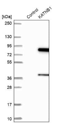Western Blot: katanin-p80 Antibody [NBP1-87503] - Analysis in control (vector only transfected HEK293T lysate) and KATNB1 over-expression lysate (Co-expressed with a C-terminal myc-DDK tag (3.1 kDa) in mammalian HEK293T cells).