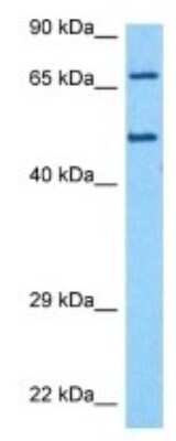 Western Blot: katanin-p80 Antibody [NBP3-10015] - Western blot analysis of katanin-p80 in Human MDA-MB-435s lysates. Antibody dilution at 1ug/ml