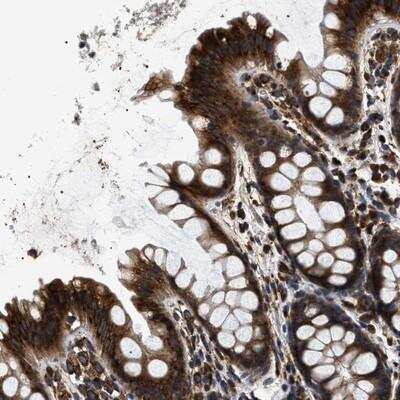 Immunohistochemistry kinectin Antibody - BSA Free