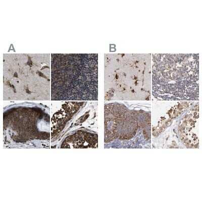 Immunohistochemistry-Paraffin kinectin Antibody - BSA Free