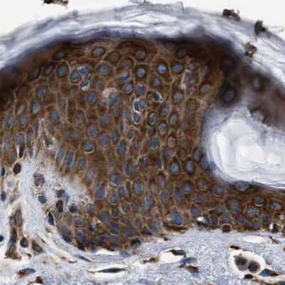 Immunohistochemistry-Paraffin kinectin Antibody - BSA Free