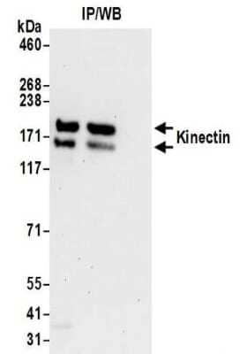 <b>Biological Strategies Validation. </b>Immunoprecipitation: kinectin Antibody [NBP2-32261] - Samples:  Whole cell lysate (0.5 or 1.0 mg per IP reaction; 20% of IP loaded) prepared using NETN buffer from 293T cells. Antibodies:  Affinity purified rabbit anti-Kinectin antibody NBP2-32261 used for IP at 6 ug per reaction. For blotting immunoprecipitated Kinectin, NBP2-32261 was used at 1 ug/ml.  Detection: Chemiluminescence with an exposure time of 30 seconds.