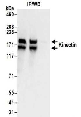 <b>Biological Strategies Validation. </b>Immunoprecipitation: kinectin Antibody [NBP2-32262] - Samples:  Whole cell lysate (0.5 or 1.0 mg per IP reaction; 20% of IP loaded) prepared using NETN buffer from 293T cells. Antibodies:  Affinity purified rabbit anti-Kinectin antibody NBP2-32262 used for IP at 6 ug per reaction. For blotting immunoprecipitated Kinectin, NBP2-32262 was used at 1 ug/ml.  Detection: Chemiluminescence with an exposure time of 3 seconds.