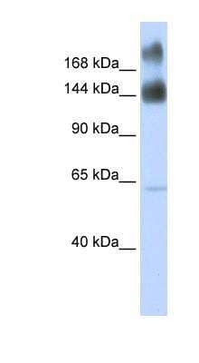 Western Blot: kinectin Antibody [NBP1-91592] - Human Brain lysate, concentration 0.2-1 ug/ml.