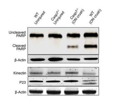 Western Blot: kinectin Antibody [NBP1-91592] - Representative western blot images of uncleaved and cleaved PARP, kinectin, as well as cleaved and uncleaved co-chaperone P23 in retinal protein extracts from WT or Casp7 -/- mice, uninjured or 7 d after ON crush. Image collected and cropped by CiteAb from the following publication (//molecularneurodegeneration.biomedcentral.com/articles/10.1186/s13024-015-0039-2) licensed under a CC-BY license.