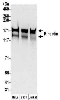 Western Blot: kinectin Antibody [NBP2-32262] - Samples:  Whole cell lysate (50 ug) prepared using NETN buffer from HeLa, 293T, and Jurkat cells.  Antibodies:  Affinity purified rabbit anti-Kinectin antibody NBP2-32262 used for WB at 0.1 ug/ml.  Detection: Chemiluminescence with an exposure time of 3 seconds.