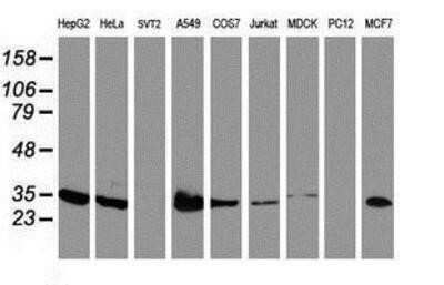 Western Blot: lactamase, beta 2 Antibody (OTI2F9) - Azide and BSA Free [NBP2-71901] - Analysis of extracts (35ug) from 9 different cell lines by using anti-lactamase, beta 2 monoclonal antibody.