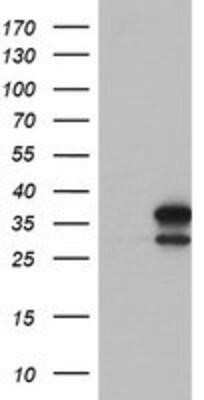 Western Blot: lactamase, beta 2 Antibody (OTI2F9) - Azide and BSA Free [NBP2-71901] - HEK293T cells were transfected with the pCMV6-ENTRY control (Left lane) or pCMV6-ENTRY lactamase, beta 2 (Right lane) cDNA for 48 hrs and lysed. Equivalent amounts of cell lysates (5 ug per lane) were separated by SDS-PAGE and immunoblotted with anti-lact
