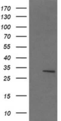 Western Blot: lactamase, beta 2 Antibody (OTI4F7) - Azide and BSA Free [NBP2-71903] - Analysis of HEK293T cells were transfected with the pCMV6-ENTRY control (Left lane) or pCMV6-ENTRY lactamase, beta 2.