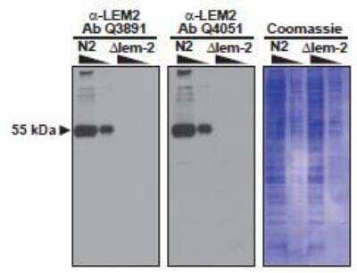 Western Blot: lem-2 Antibody [48540002] - This image is specific to animal number SDQ3891 Samples: N2 embryos (N2) or embryos from a lem-2  null mutant (?lem-2, VC1317) Antibody concentration: 1:5000 dilution