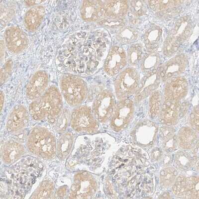 Immunohistochemistry-Paraffin: lipoyltransferase 1 Antibody [NBP1-92073] - Staining of human kidney shows weak cytoplasmic positivity in cells in tubules.