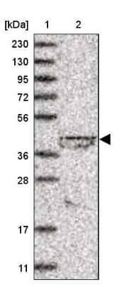 Western Blot lipoyltransferase 1 Antibody - BSA Free