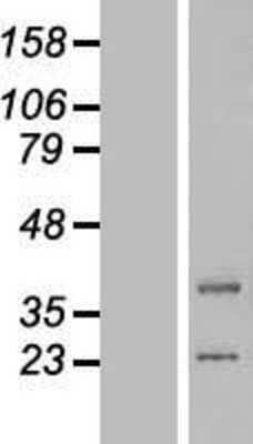 Western Blot: lipoyltransferase 1 Overexpression Lysate (Adult Normal) [NBP2-05505] Left-Empty vector transfected control cell lysate (HEK293 cell lysate); Right -Over-expression Lysate for lipoyltransferase 1.