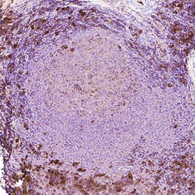 Siglec‑2/CD22 was detected in immersion fixed paraffin-embedded sections of Human Tonsil using Llama Anti-Human Siglec‑2/CD22 LlaMABodyTM Bivalent VHH HuIgG2 Fusion Monoclonal Antibody (Catalog # LMAB107321) at 15 &micro;g/mL overnight at 4 &deg;C. Tissue was stained using anti-Llama secondaries with HRP and counterstained with hematoxylin (blue). Specific staining was localized to cytoplasm in lymphocytes. View our protocol for IHC Staining with VisUCyte HRP Polymer Detection Reagents.