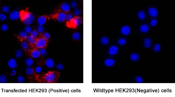Siglec‑2/CD22 was detected in immersion fixed Transfected HEK293 Human Embryonic Kidney Cell Line (Positive) and absent in Wild Type HEK293 Human Embryonic Kidney Cell Line (Negative) Cells using Llama Anti-Human Siglec‑2/CD22 LlamabodyTM VHH His-tag Monoclonal Antibody (Catalog # LMAB10732) at 5 &micro;g/mL for 3 hours at room temperature. Cells were stained using Anti-camelid Vhh conjugated to Rhodamine-Red X (red) and counterstained with DAPI (blue). Specific staining was localized to cytoplasm. View our protocol for Fluorescent ICC Staining of Cells on Coverslips.