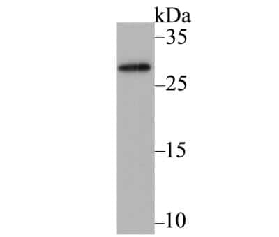Western Blot: mAID Tag Antibody [NBP2-89163] - Analysis of Mini-AID-tag on fusion protein using anti-Mini-AID-tag antibody at 1/5,000 dilution.