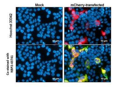 Immunocytochemistry/Immunofluorescence: mCherry Antibody (844) [NBP2-43778] - mCherry antibody detects mCherry protein at cytoplasm by immunofluorescent analysis. Sample: Mock and transfected 293T cells were fixed in 4% paraformaldehyde at RT for 15 min. Green: mCherry stained by mCherry antibody diluted at 1:1000. Red: mCherry is expressed in the transfected cell. Blue: Hoechst 33342 staining. Scale bar= 10um.