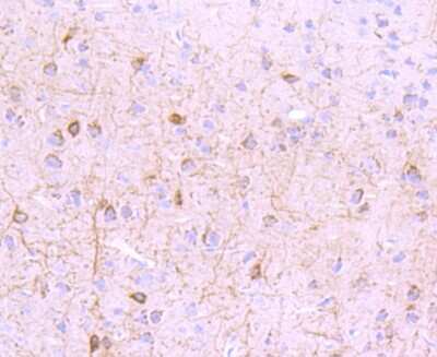Immunohistochemistry-Paraffin: mGluR1 Antibody (JM11-61) [NBP2-66945] - Analysis of paraffin-embedded mouse brain tissue using anti-mGluR1 antibody. Counter stained with hematoxylin.